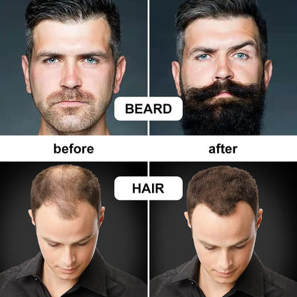 URAQT Dermaroller Microagulhas 0.5mm Titânio | Rosto e Corpo Anti-Idade | Cosmética