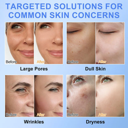 BIO COLLAGEN Máscara Facial Hidrogel 4 Peças | Hidratação Profunda Anti-Idade | Parafarmácia