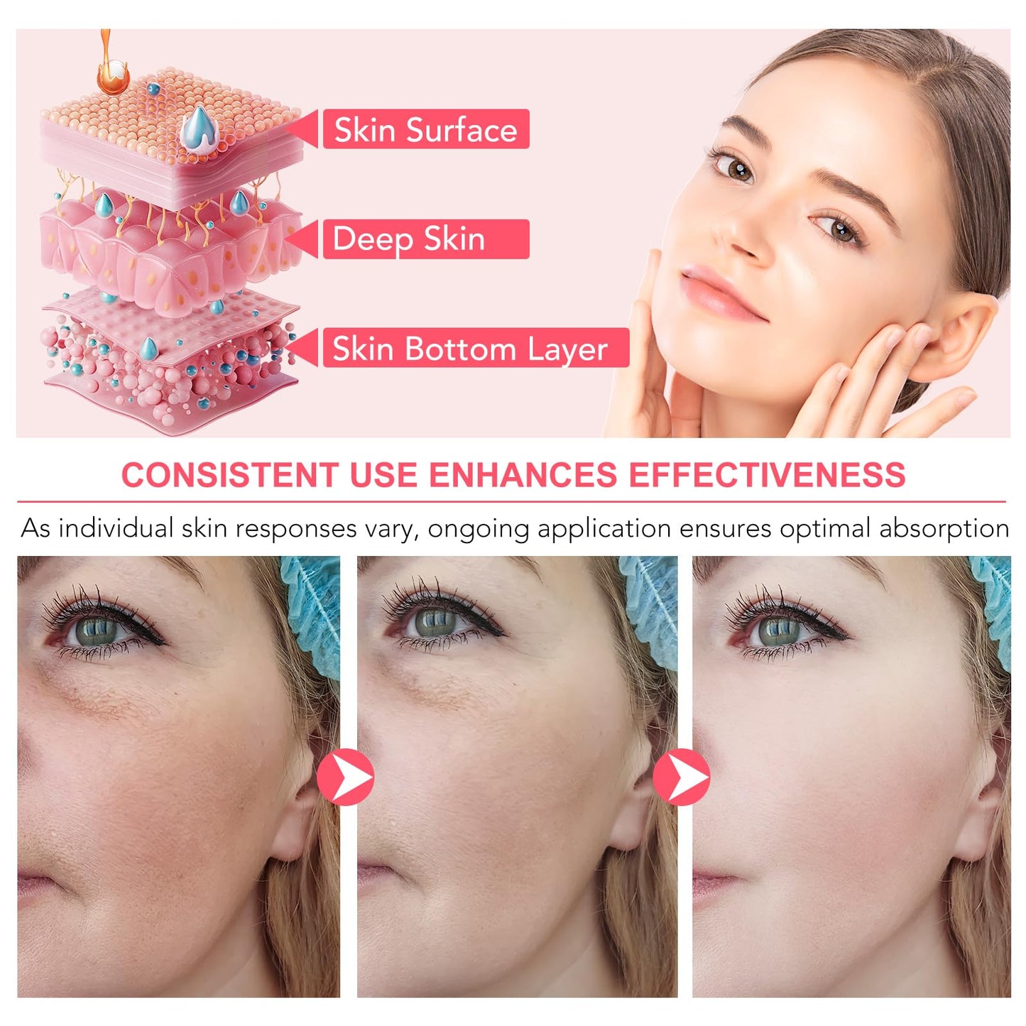 BIO COLLAGEN Máscara Facial Hidrogel 4 Peças | Hidratação Profunda Anti-Idade | Parafarmácia