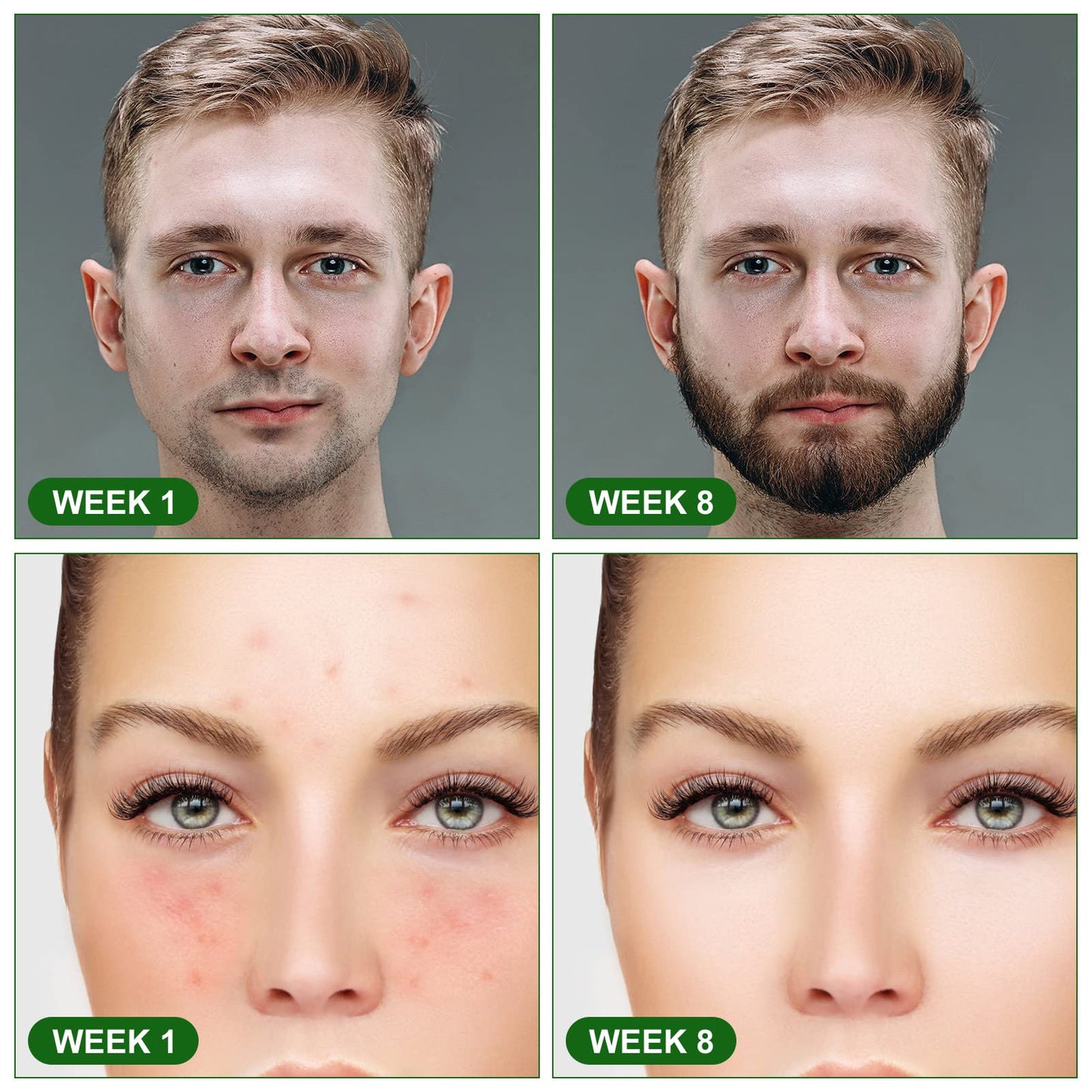 URAQT Dermaroller Microagulhas 0.5mm Titânio | Rosto e Corpo Anti-Idade | Cosmética